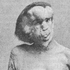 Kvůli svému vzhledu našel Joseph Merrick práci jen v panoptiku