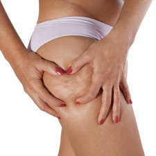 S bojem proti pomerančové kůži vám pomůže mimo jiné i dodržování doporučeného pitného režimu