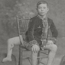 Frank Lentini by měl důvod ke stížnostem, ale postavil se osudu a žil celkem normální život