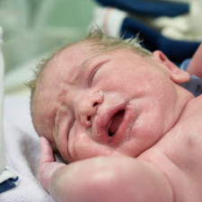 První císařský řez v historii, při němž přežila současně matka i dítě, byl pravděpodobně proveden roku 1337 v Praze na dvoře Jana Lucemburského