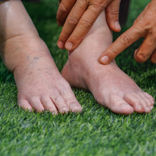 Na vině však může být selhávající srdce, které nedokáže správně přečerpat krev a udržet veškerou tekutinu v oběhu