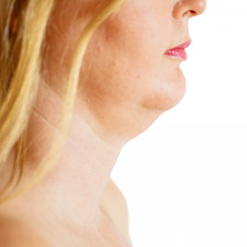 Zbavit se podbradku vám pomohou mimo jiné i cviky s jazykem